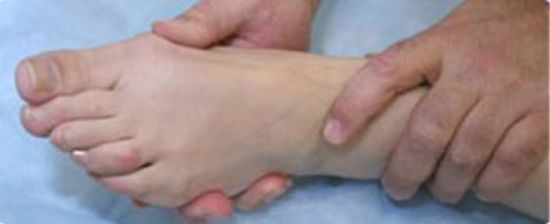 Picture of Valgomed 2x Silicone Gel Bunion Hallux Valgus Separator Fixative bales Toes
